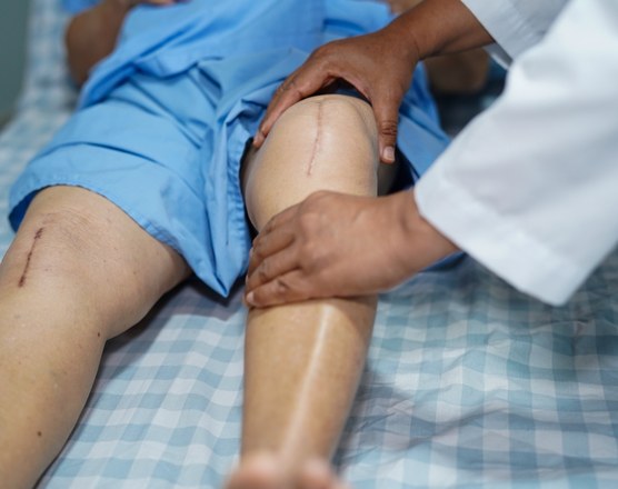A clinician's hands examining a patient's calf and knee after surgery